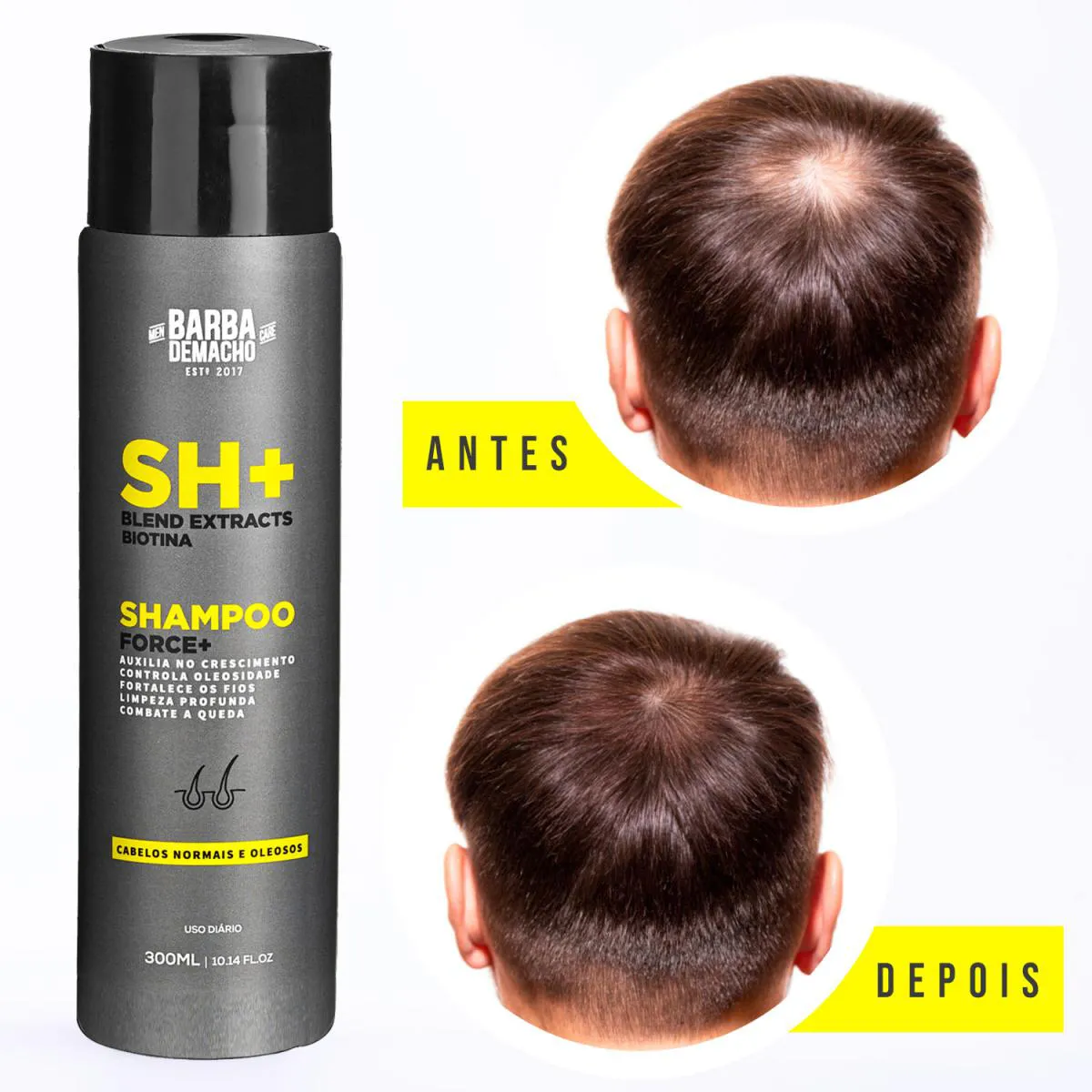 XAMPU CAPILAR SH FORCE + ANTIQUEDA E FORTALECEDOR 300ML
