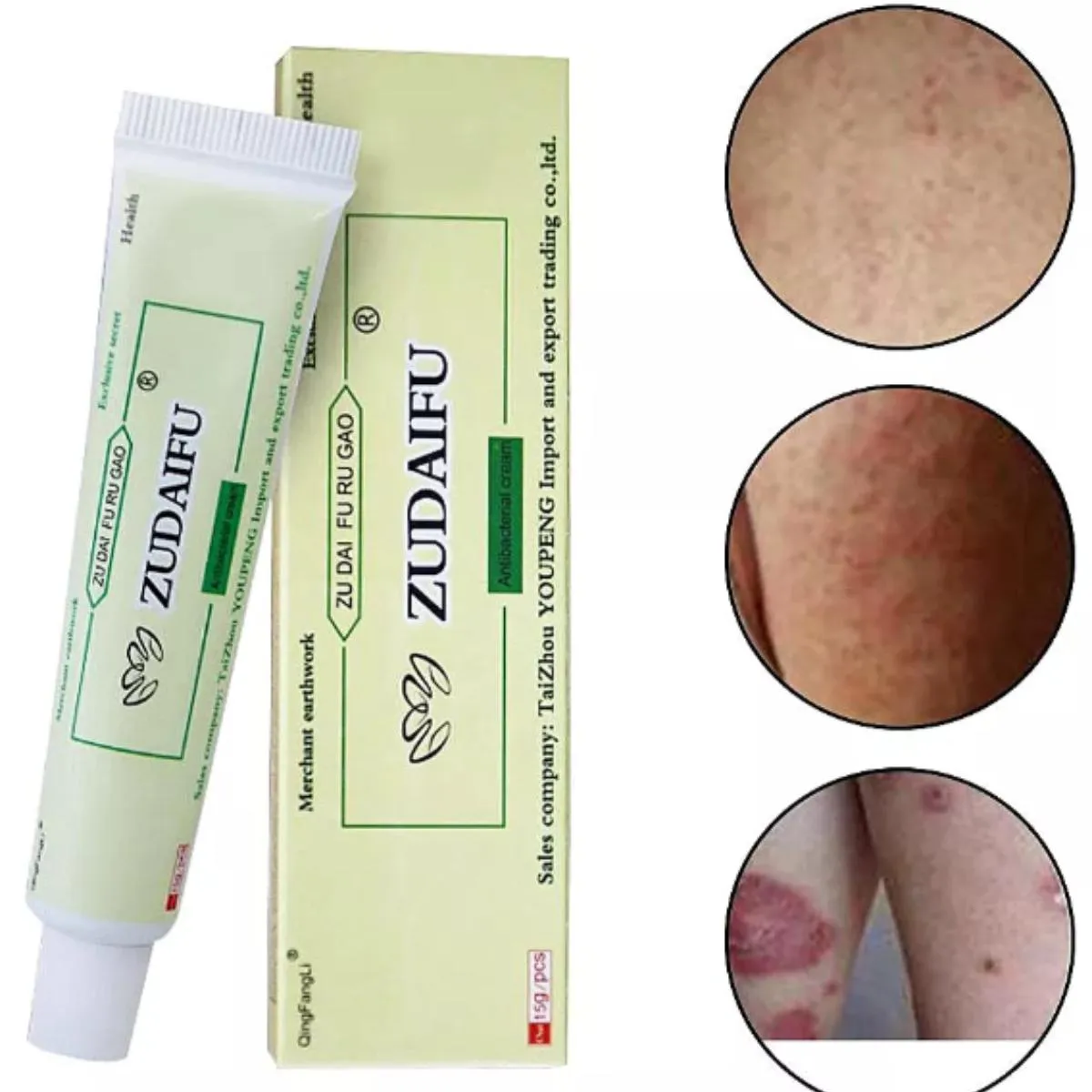 ZUDAIFU POMADA PARA TRATAMENTO DA PSORíASE, DERMATITE, COCEIRA, VERMELHIDãO E INFECçõES DE PELE
