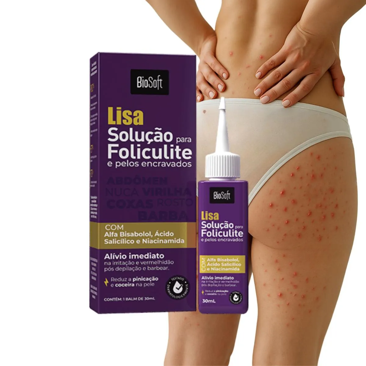 CREME PARA FOLICULITE NO GLUTEO VIRILHA COXA PELO ENCRAVADO