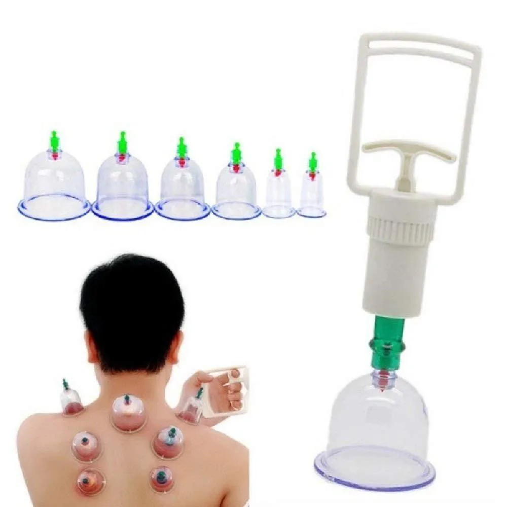 KIT VENTOSAS COM BOMBA VENTOSATERAPIA 6 COPOS MASSOTERAPIA CHINES ACUPUNTURA TERAPIA SUCçãO ESTéTICA