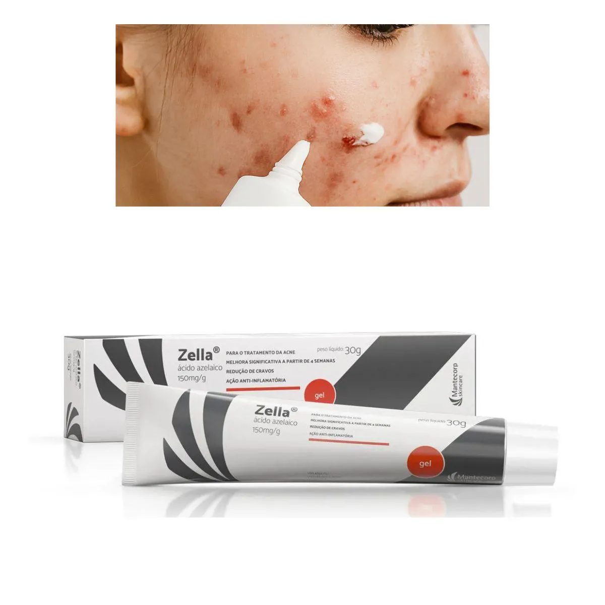 Gel Facial Zella150Mg/G Ácido Azelaico 30G | Droga Raia | Droga Raia